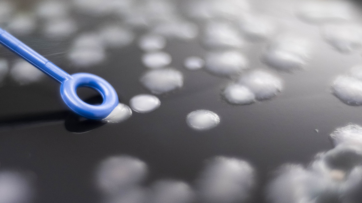 Dettaglio analisi legionella